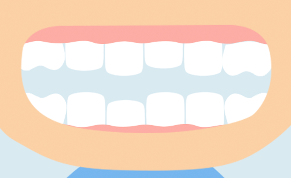 ガタガタの歯ならびの原因